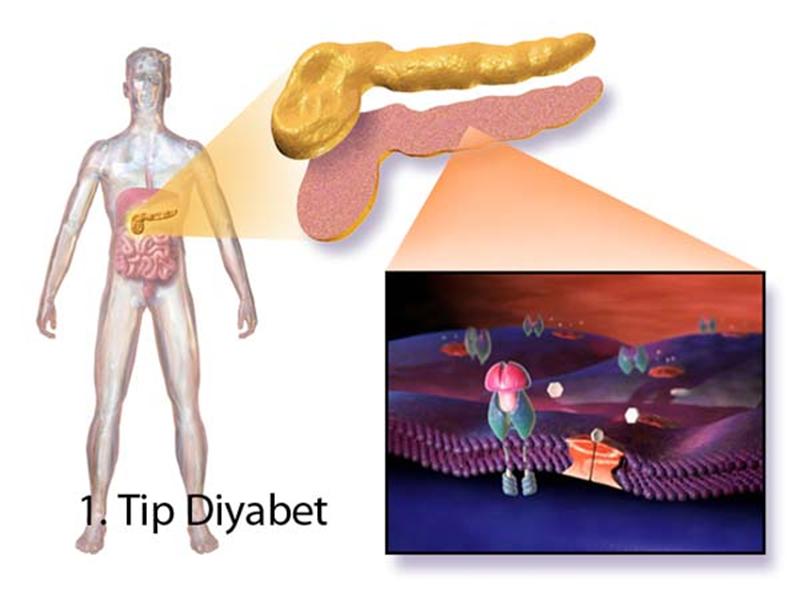 Şeker Hastalığı