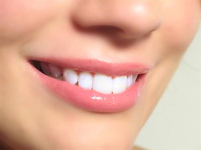 Organik Temizlik Sırası Dişlerde