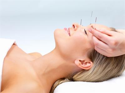 Menopozda Akupunktur