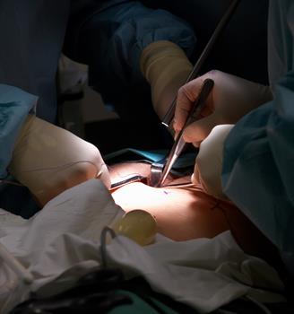 Laparoskopik Cerrahi, İnce Bağırsak Tıkanmaları  Riskini Azaltıyor