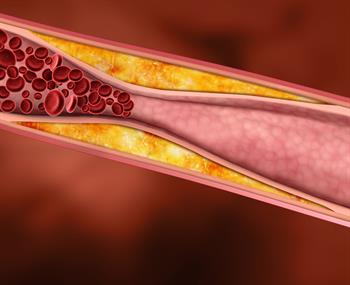 C-Reaktif Protein ve Enflamasyon