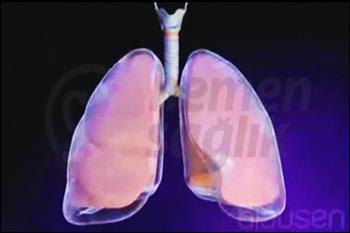 Akciğerin Sönmesi (Pnömotoraks)